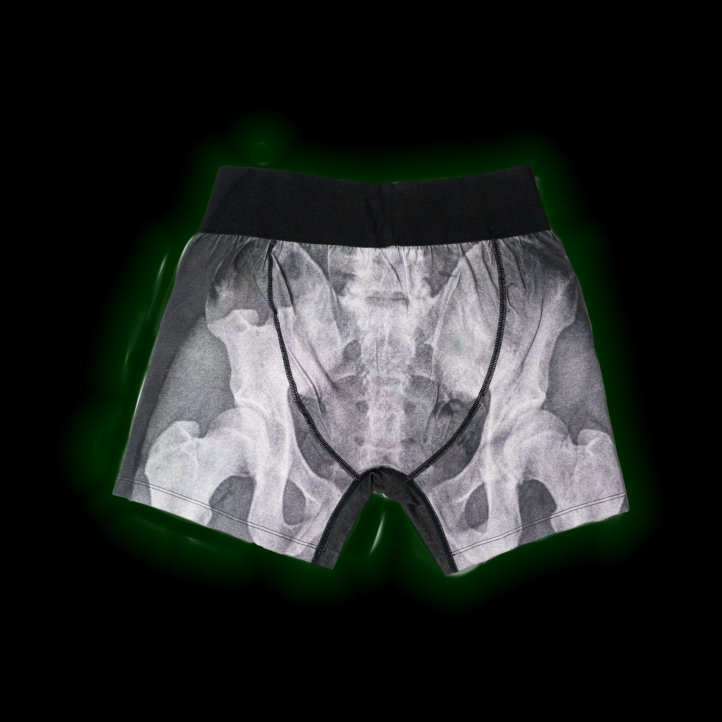 X-RAY BRIEF